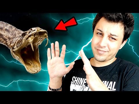 VIPER BITE! HOW TO SURVIVE?