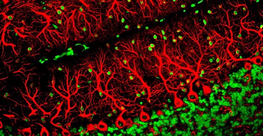 Définition | Cellule de Purkinje : qu'est-ce que c'est ? | Futura santé