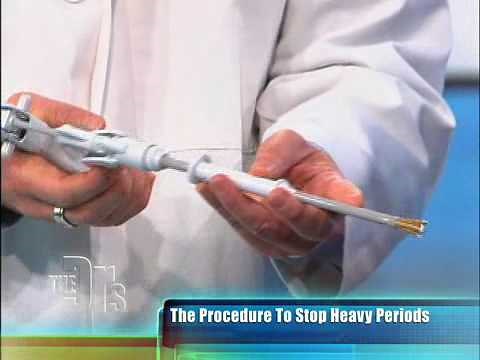 Novasure Procedure Performed on 'The Doctors'