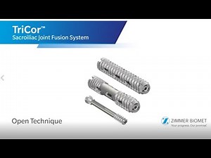 Zimmer Biomet: TriCOR Open Technique