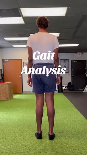 This is what we saw from his gait analysis. Femoral anteversion is where the angle of the femur is structurally different coming into the hip joint. It’s can be understood better with the Craig’s Test. And it’s something that we can’t change (structural) so for him, we encourage him to turn his feet in. And we strengthen into it! #physicaltherapy #physicaltherapist #physio #physiotherapy #movement #movementismedicine #move #movementassessment #movementanalysis #omnimovementanalysis #gaitanalysis