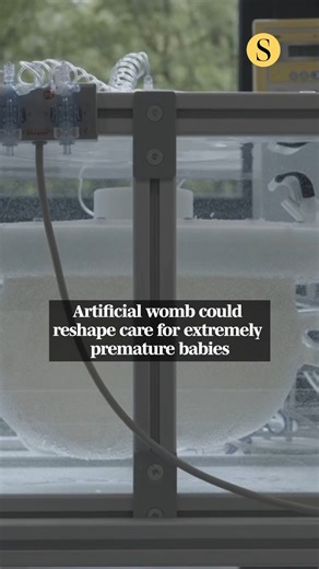 An artificial womb, designed to replicate the conditions of still being inside the mother's body, could save the lives of very premature babies. The technology, known as AquaWomb, is still in its early stages. But it's been made to support infants born between 24 and 28 weeks of pregnancy — a period when survival is possible but complications are common. The AquaWomb project in Eindhoven, Netherlands remains experimental. Just four additional weeks of development can dramatically improve surviva