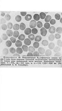 Blood Microscopy: Feedback from the Body. What Was Blood Like in 1965?
