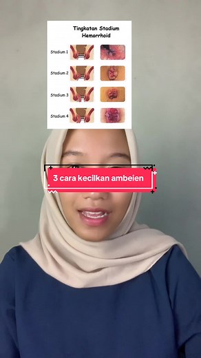 3 Cara Efektif Kecilkan Ambeien