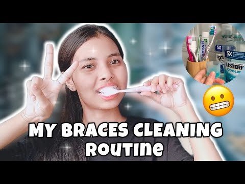 Braces Cleaning Routine 🦷✨ | Complete Guide with Brushing, toothpaste, Mouthwash & Wax
