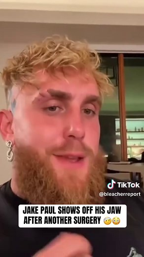 Jake Paul Undergoes Jaw Surgery Due to Loose Screws
