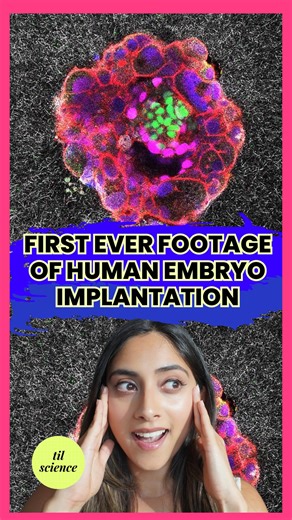 Dr. Harini Bhat (PharmD) | Science Storyteller | This is the first ever footage of a human embryo implanting in the uterine tissue in real time!! For decades, we no idea why 60% of... | Instagram