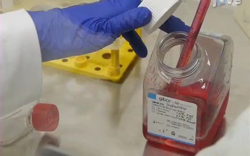 【搬运】Tube Formation | 血管形成实验 | 小管形成实验 | 成管实验