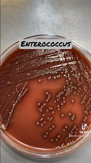 Enterococcus faecalis #microbiology #bacteria #labtech #medicallaboratory #laboratory #learning