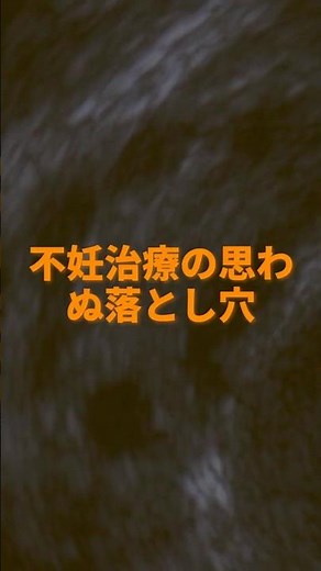 卵巣過剰刺激症候群（OHSS）の矛盾する治療