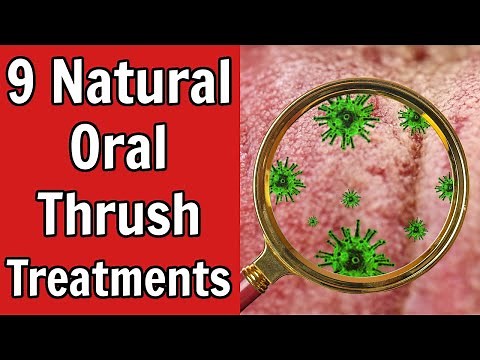 9 Natural Oral Thrush Treatments