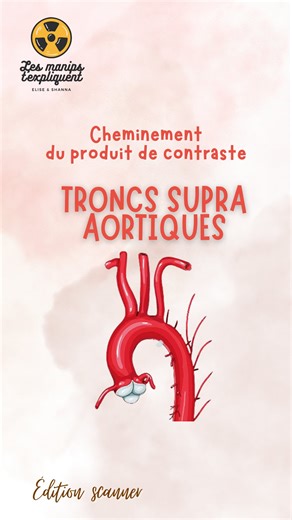 Dans le dernier réel, on vous expliquait le cheminement du produit de contraste du pli du coude jusqu’au cœur. ♥️ Maintenant, on vous explique les TSA, suivez les guides ! 🚗 . Ça vous dit une partie 3 sur le polygone de Willis ? 🧠 #manipradio #lesmanipstexpliquent #scanner #injection TSA = troncs supra aortiques | Les manips t'expliquent