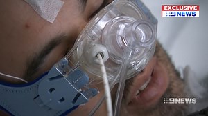 New device labelled “game changer” for sleep apnoea sufferers