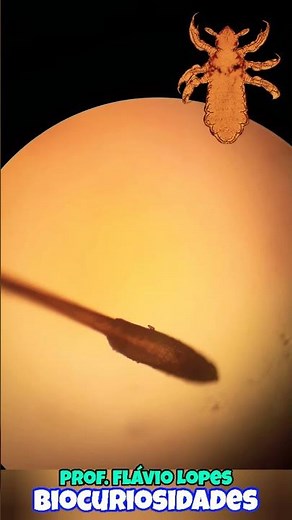 Hair and lice egg under a microscope. #BioCuriosities
