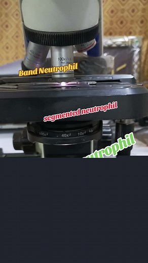 Understanding Neutrophil Morphology and Types