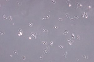 File:DNA-Lesions-Induced-by-Replication-Stress-Trigger-Mitotic-Aberration-and-Tetraploidy-Development-pone.0008821.s003.ogv - Wikimedia Commons