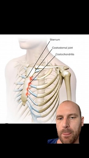 ✨NON-CARDIAC CHEST PAIN✨ *Disclaimer: if you have chest pain have it checked immediately to rule out a cardiac origin* Do you have chest pain without a heart condition!? -> Check your breathing 😮‍💨 We’ve all heard “breath with the diaphragm” but what does that mean? I’ll cover that next post but here is a case of chest pain due to diaphragm dysfunction (mostly) and why this is important in the first place. . A 30 yo active female patient came in with activity related chest pain after ruling ou