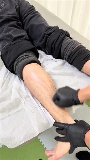 Revolutionary Techniques to Restore Ankle Sprain Dorsiflexion