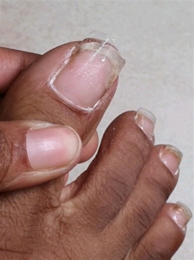 Full toe nail tutorial 👣 | How I do my own toes at home (step by step) I compiled all 3 parts of my toe nail tutorial into one video so you can follow the full process from start to finish — removal, prep, repair, application, and finishing. No voice over, just the process so you can really watch and learn at your own pace. This is for anyone who wants to: • learn how to do their own toes at home • avoid nail damage • get salon-style toes safely 💬 Leave a comment and tell me what you think 💾 