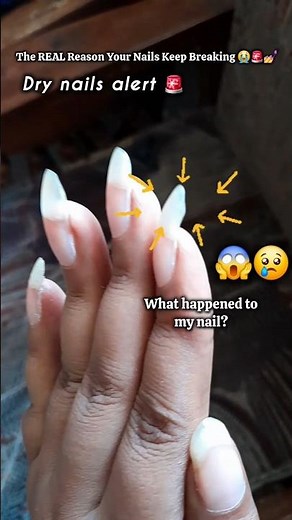 The REAL Reason Your Nails Keep Breaking 😭😰😱#nails #nailcare #longnails #shortsfeed #nailgrowth