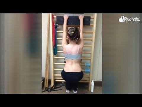 What is Schroth Therapy?