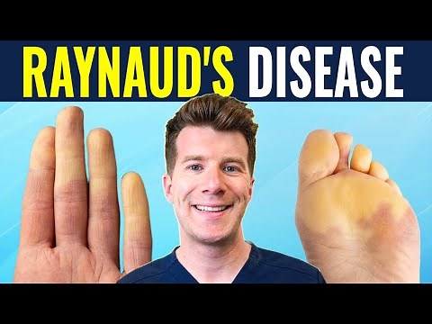 Doctor explains Raynaud's disease and syndrome | Causes, prevention and treatment