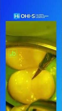 🔷 Mastering direct composite restorations for severely damaged teeth!