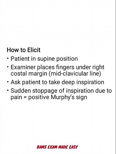 MURPHY'S SIGN #Clinical signs 🛑 #bams #medicalstudent #clinics