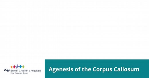 Agenesis of the Corpus Callosum