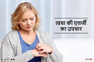 Skin Allergy Treatment in Hindi - त्वचा की एलर्जी का इलाज