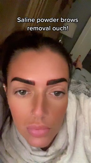 Saline Powder Brows Removal Experience