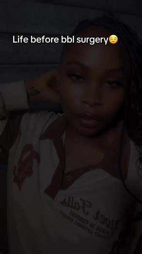 Life After BBL Surgery: What to Expect