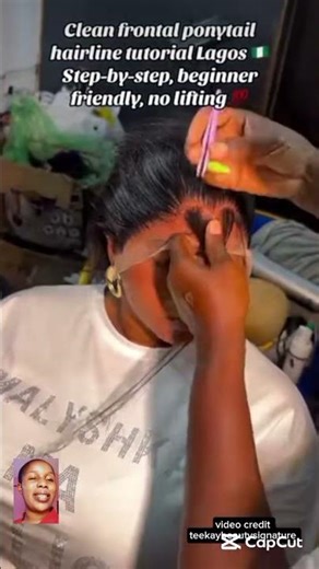 frontal installation tutorial