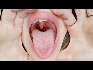 My Mouth Tour and Uvula ASMR Visual (WITH SOUNDS)