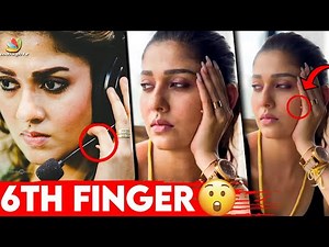 😱பலருக்கும் தெரியாத Nayanthara-வின் ஆறாம் விரல் | Nayan's Sixth Finger | vignesh Shivan