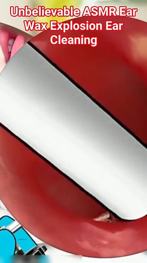 Unbelievable ASMR Ear Wax Explosion Ear Cleaning | #trending #reels #cleaning #video #shorts | Akhilesh Yadav