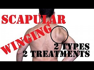 How to Fix Scapular Winging (and Why it Happens)