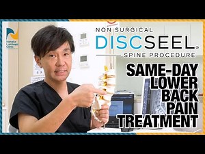 Discseel® Procedure Features Explained! (Spinal Disc Regenerative Treatment)