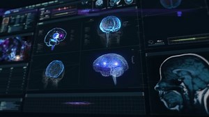 Futuristic HUD Interface Showing Brain and Neurons Anatomy and MRI Information. Illness Analysis Scans Human Brain Organ. Examination Software Diagnostic. EKG and Vital Signs. Healthcare