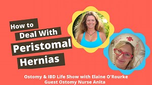 How to Deal with Peristomal Hernias - United Ostomy Associations of America