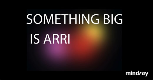 The new standard of ultrasound is almost here! Visit the Mindray booth to experience the live debut of our Ultra Solution at RSNA 2025. Built for sharp imaging, intelligent automation, and seamless workflows, this solution is ultra precise, ultra easy, and ultra smart. This new premium ultrasound solution is built to perform, designed to adapt, and backed by a partner that shows up every time. Be the first to see what's coming at RSNA. Learn More >>> https://www2.mindray.com/rsna25 #UltraSolutio