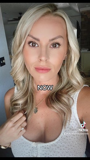 A story of a lazy eye’d girls glow up. 👀 #foryou #fyp #duet #tiktok #viral #trending #lazyeye #comedy #funny #strabismus