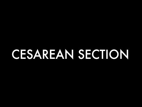 Cesarean Section