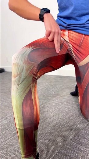 Key Aspects of Patellofemoral Pain Syndrome Examination