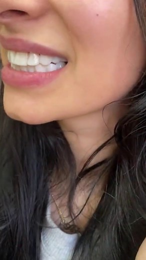 Invisible teeth braces offer a discreet way to align teeth. Learn how they work, the process involved, and what to expect. Explore more to get the details. | Control Z | Facebook