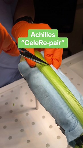 Achillies Midsubstance SpeedBridge - PARS System | Orthopedics