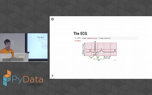 【cc字幕】ECG(心电)信号分析