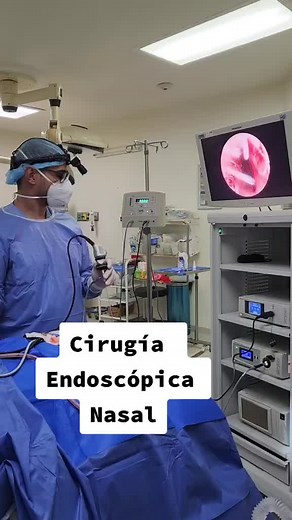 La cirugía endoscópica nasal permite el abordaje de las enfermedades que afectan los senos paranasales, principalmente rinosinusitis con o sin pólipos sin dejar cicatrices. Para una evaluación escribe o llámanos al 3336-5373. #otorrino #otorrinosps #rinitis #sinusitis