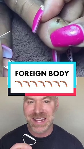 How to Remove a Splinter from Your Nail