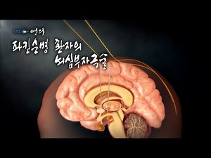 [Encyclopedia of Medical Sciences📖] Deep Brain Stimulation in Parkinson's Disease Patients
